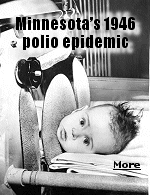 Poliomyelitis - often called infantile paralysis at the time - grew increasingly common during the first half of the 20th century. Highly contagious, its early symptoms often mimicked the flu, with a low-grade fever, a headache and a sore throat. Severe cases could result in muscle weakness, paralysis or death. Children were especially susceptible.